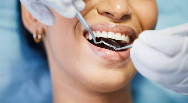 Best Broken or Chipped Tooth Repair in Orangevale, CA
